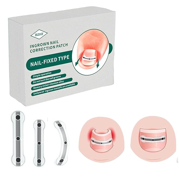 Ingrown Toenail Removal Kit | Titanium Alloy Ingrown Toenail Treatment | Pedicure Tools for Feet, Nail Tools Specially Designed for Curved Nail Repair and Ingrown Toenail Corrector (0.67/0.79in)