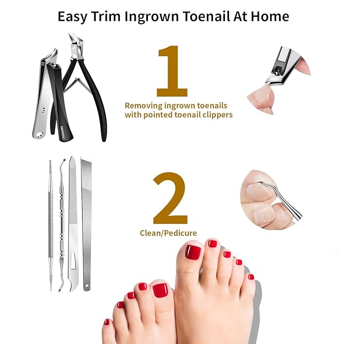 Ingrown Toenail Removal Kit, 6PCS Stainless Steel Toe Nail Kit, Straight Edge Oblique and Curved Slanted Nail Clippers Cutters for Ingrown Nails, Professional Pedicure Tool at Home