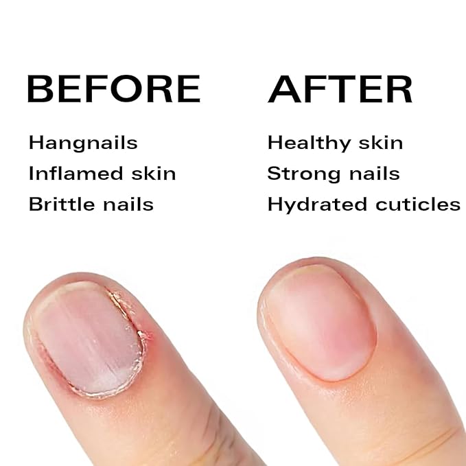 Nail Oil Cuticle Pen - Watermelon - Nail Strengthener & Growth Serum with Vitamin A, D, E, B5, Grapeseed & Natural Oils - Repair for Brittle, Peeling, Thin Nails - Valentine's Gift Idea