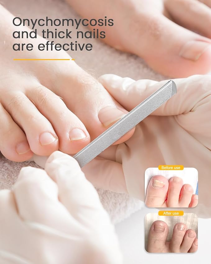 BEZOX Long Metal Nail File, Stainless Steel Fingernail File for Thick and Fungal Nails with Dual-Ended Toenail Lifter – The Ultimate Manicure & Pedicure Tool for Men and Women’s Nail Care - Black