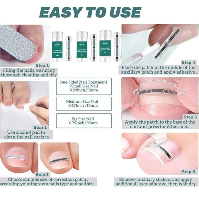 Ingrown Toenail Removal Kit | Titanium Alloy Ingrown Toenail Treatment | Pedicure Tools for Feet, Nail Tools Specially Designed for Curved Nail Repair and Ingrown Toenail Corrector (0.67/0.79in)