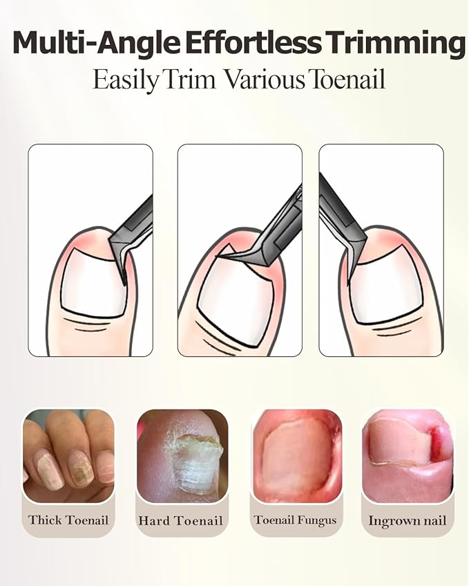 Toenail Clippers for Ingrown & Thick & Hard Nails - Ingrown Toenail Clippers for Men Women Seniors - Fingernail Toe Nail Clippers with Sharp Blades/Effort-Saving Spring/Long Non-Slip Handle Design