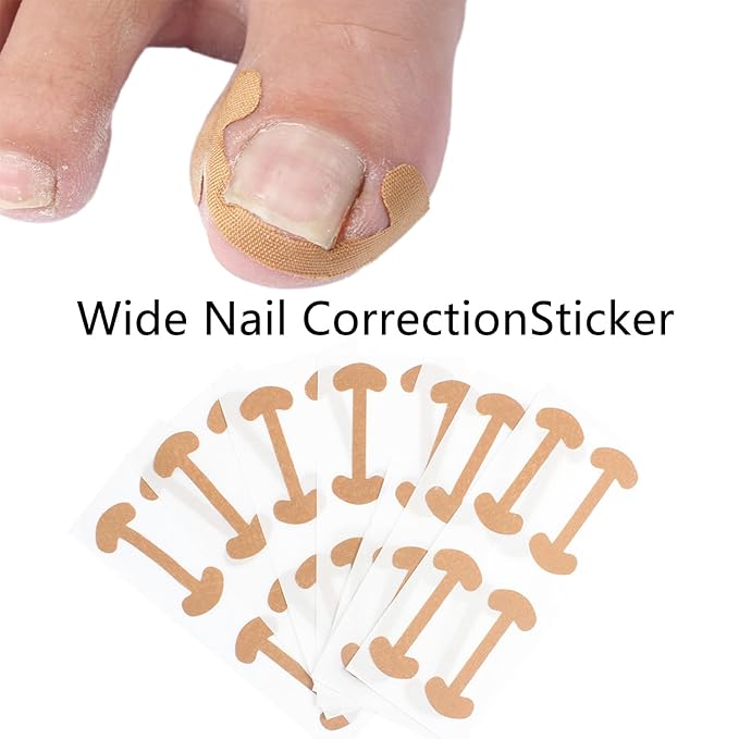Professional Ingrown Toenail Correction Kit - Stainless Steel Ingrown Toenail Clippers, Correction Patches, Lifter & Tools for Ingrown Toenail Treatment, Home Pedicure Solution