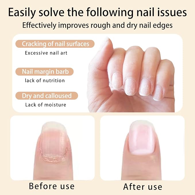 12pcs Cuticle Oil Pen Sweet Almond Nail Growth Serum and Repair Treatment Hydrating Oil for Dry Cuticles and Skin Cuticle Buddy Revitalize Nails with Radiant Cosmetics' Nail Growth Oil