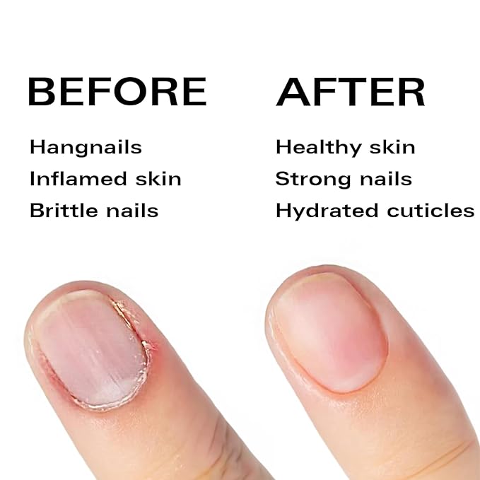Nail Oil Cuticle Pen - Fragrance Free - Nail Strengthener & Growth Serum with Vitamin A, D, E, B5, Grapeseed & Natural Oils - Repair for Brittle, Peeling, Thin Nails Valentine's Gift Idea