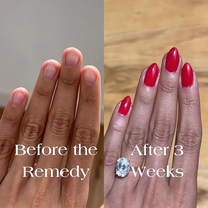 Botanist The Remedy | Nail Strengthening Polish | Repairs & Hardens Nails Damaged from Acrylics, Dip & Gel Manicures | Non-Toxic, 84% Plant Based, 21-Free & Vegan (Poppy Red)