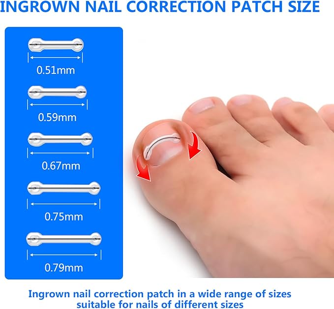 Ingrown Toenail Treatment, Toenail Correction Strips for Curved or Ingrown Nails, Quick Relief, Nail Correction, 5 Different Sizes