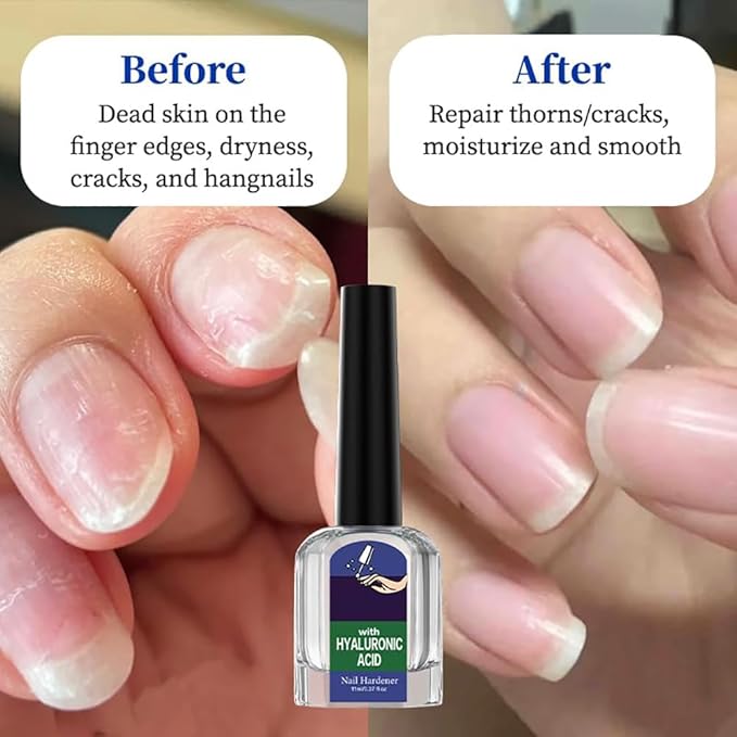 Oprtuisi Nail Care Cuticle Oil, 2-Pack Fast Absorbing Repair Serum for Cracked Cuticles, Suitable for Manicures and Home Care