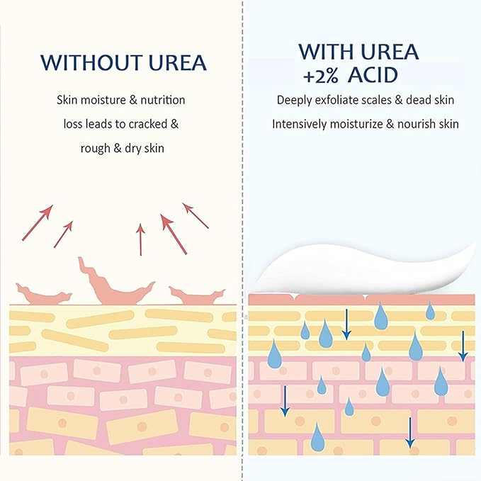 NovaCharm 45% Urea Cream with 2% Acid, Urea Foot Cream 45 Percent for Feet & Hands - Maximum Strength Foot Moisturizer for Rough, Dry, Thick & Cracked Skin, Callus Remover, Deep Hydration