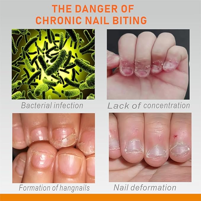 3 IN 1 Nail Biting Prevention Kit for Kids & Adults -3 Pack Includes Extra Strength+ Gentle Bitter Polish + Cuticle Oil. Fast Drying Formula Stops Nail Biting & Thumb Sucking