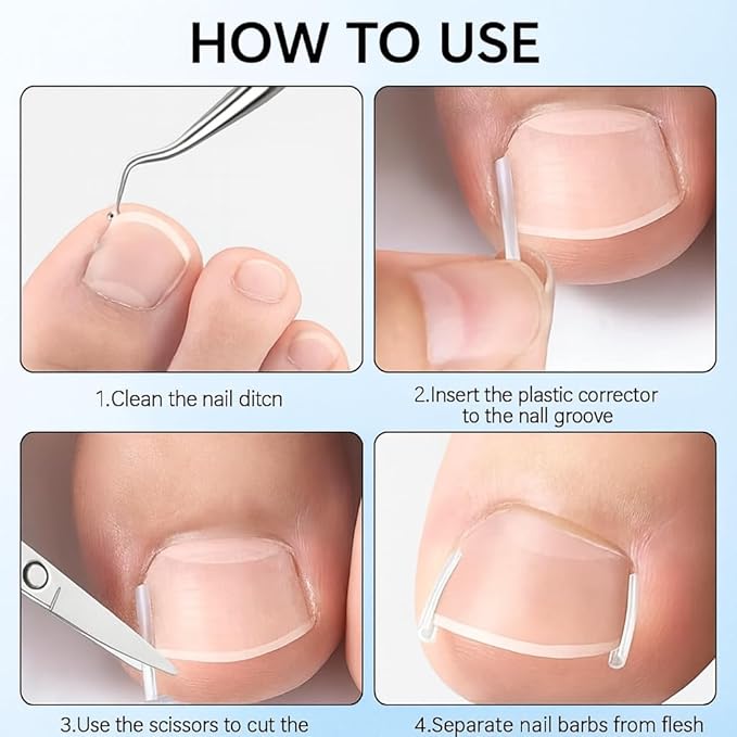 Ingrown Toenail Corrector Set, Professional Toenail Care Set with U-Shaped Breathable Strips, Curved Nail Correction Patch, Painless File & Lifter Tools, At-Home Foot Care for Men & Women.