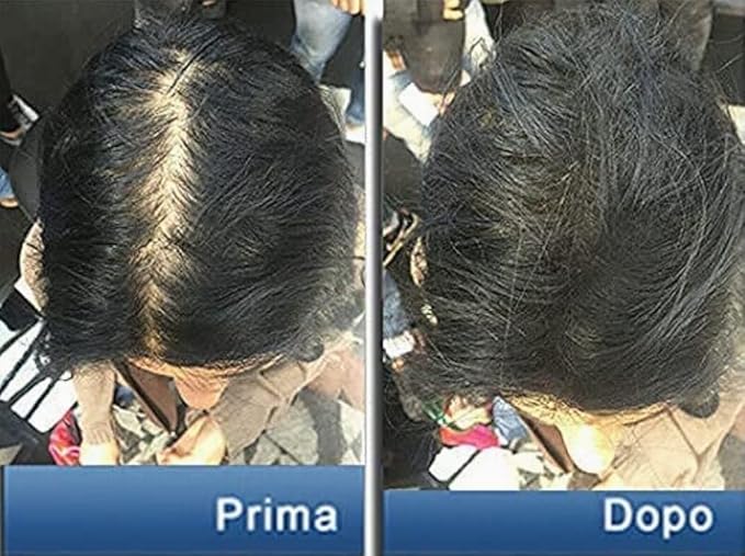 Pantogar (Pantovigar Specific Treatment for Hair and Nails - 90 Cap