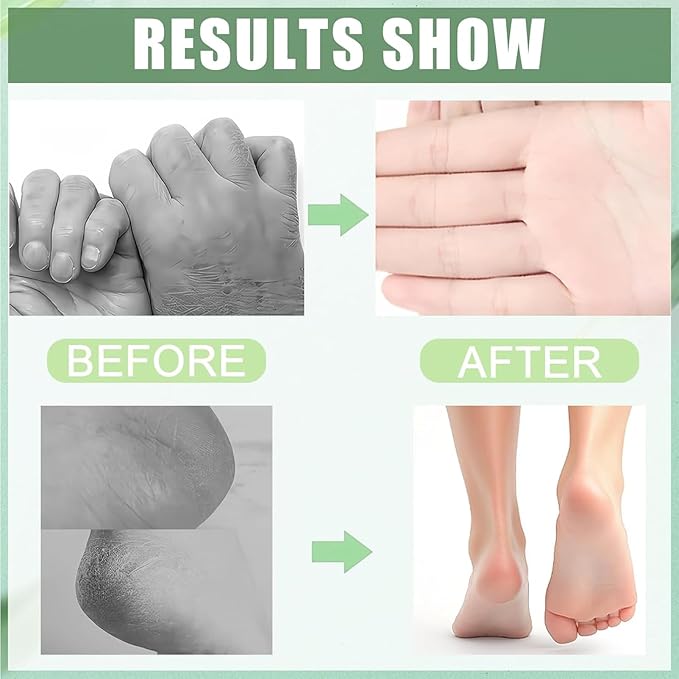 60% Urea Foot Cream, Lotion Stick Balm, Hand and Foot Cream Urea Moisturizer, Heel Stick Cream 60 Percent for Feet Maximum Strength, Heel Balm for Dry Cracked Feet, 40G 1Pc