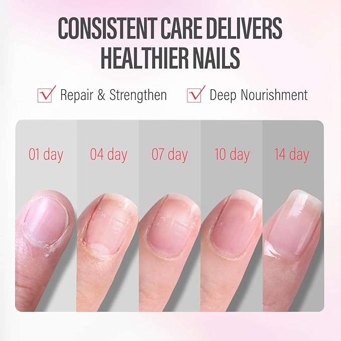 CHUCHU Nail Cuticle Oil Strengthener - Watermelon Scent Repair Growth Moisturizing Treatment - Natural Jojoba Vitamin B & E for Dry Cracked Nails
