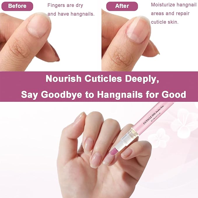 DreamCatching Ceramic Cuticle Pusher & Oil Pen, 1PC Gentle Cuticle Remover for Hangnails & Dry & Damaged Nails, Nail Care Pen for Repair & Nourish Nails