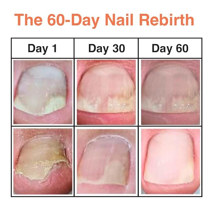 Fermentation Ampoule | Vegan Nail & Cuticle Serum | Moisturizing Nail Treatment | Herbal Fermented Ingredients | Intensive Repair Care | Natural Nail Strengthener | Korean Beauty | 15ml