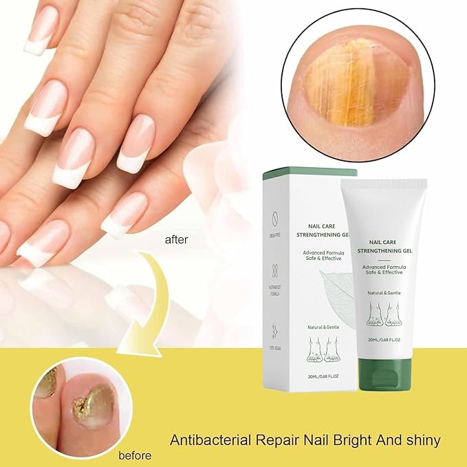Nail Fungus Treatment Gel, Natural Nail Repair Care Gel, Nail Oil for Growth & Strength, Nail Growth Serum, Strengthening Cuticle Serum - 2pcs