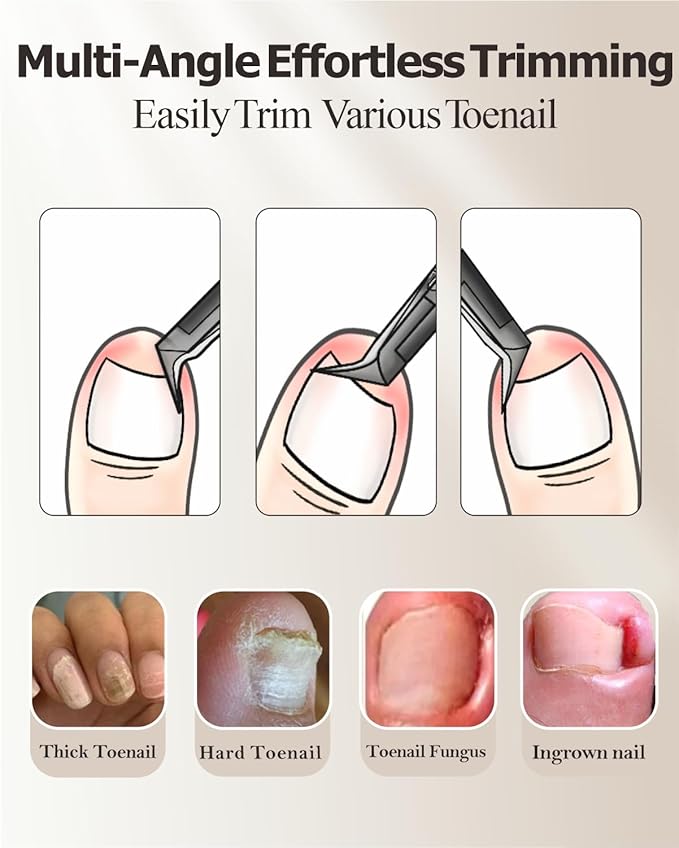 Ingrown Toenail Clippers - Toe Nail Clippers for Thick Toenails - Professional Podiatrist Toenail Clippers for Seniors Men Women with Sharp Blades/Effort-Saving Spring/Long Non-Slip Handle Design