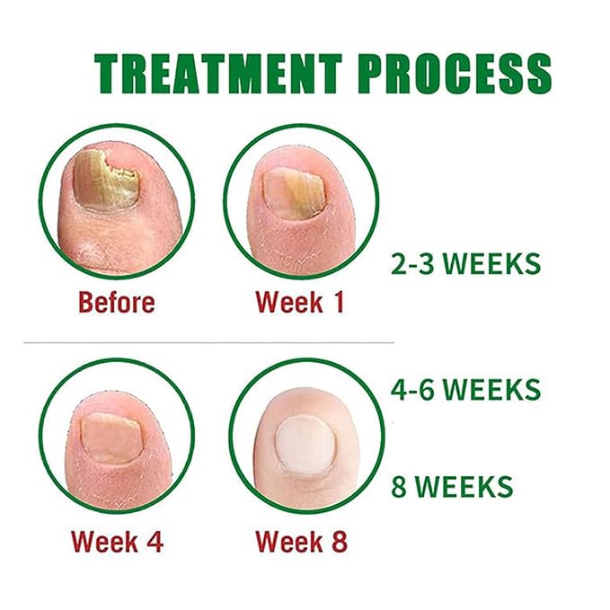 Nail Treatment Gel, Nail Growth Serum for Repair & Strengthener (1)