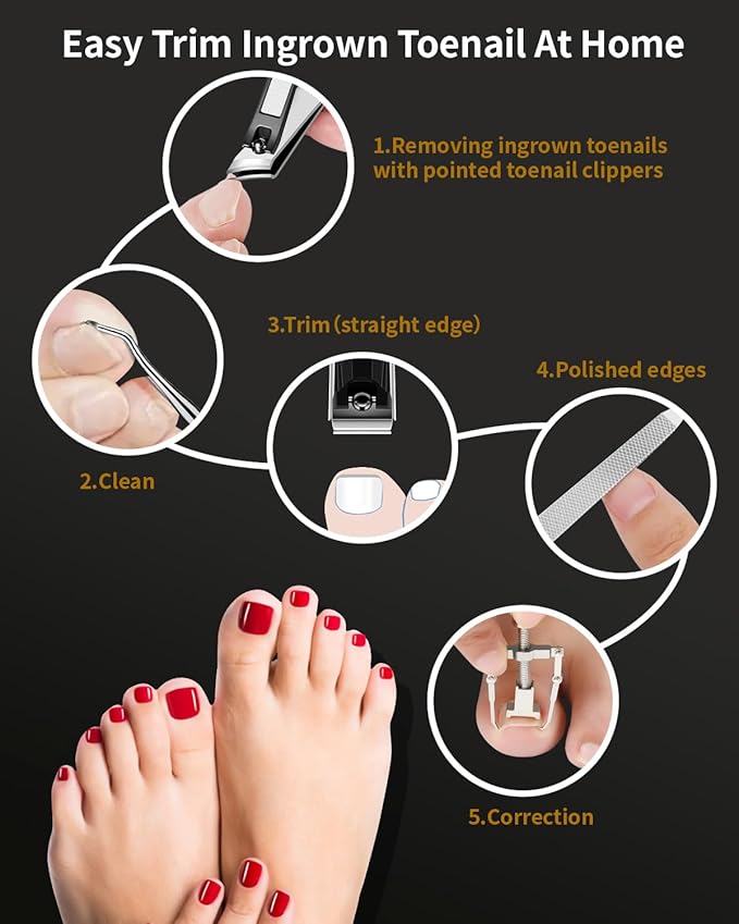 Ingrown Toenail Tool, 6 PCS Stainless Steel Pedicure Tool, Straight Edge and Curved Slanted Nail Clippers Cutters for Ingrown Toenail Correction Removal Kit at Home for Seniors, Men, Women
