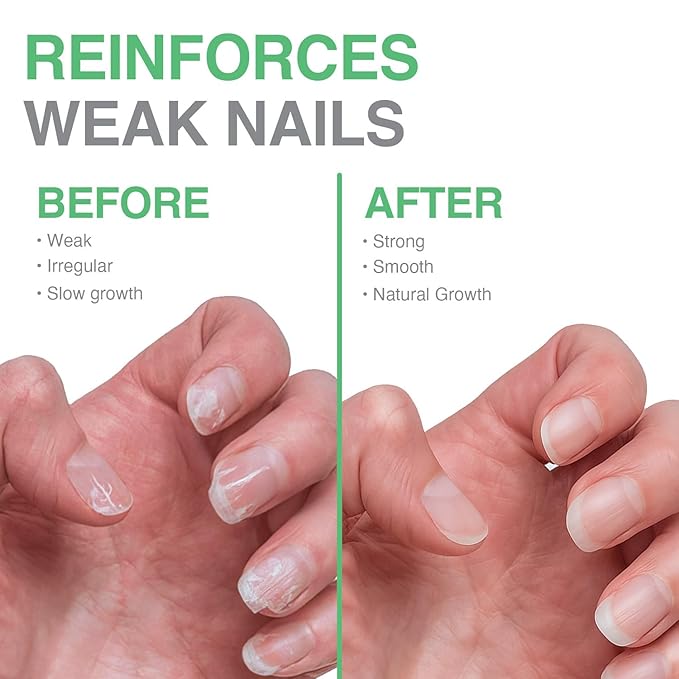 Probelle Nail Maintenance Formula 2, Nail Hardener and Strengthener for soft, brittle, and splitting nails - Reinforces, protects, conditions, strengthens, grows fingernails 5 fl oz/ 15 mL