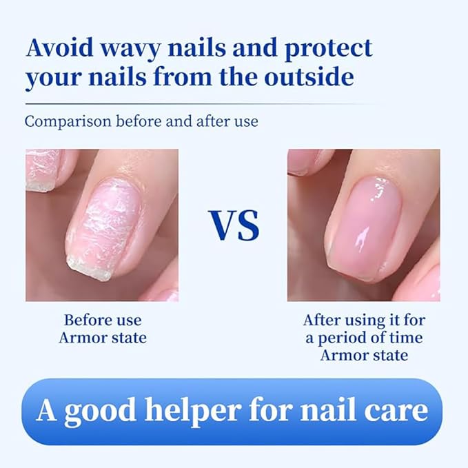 Oprtuisi Nail Care Cuticle Oil, 2-Pack Fast Absorbing Repair Serum for Cracked Cuticles, Suitable for Manicures and Home Care