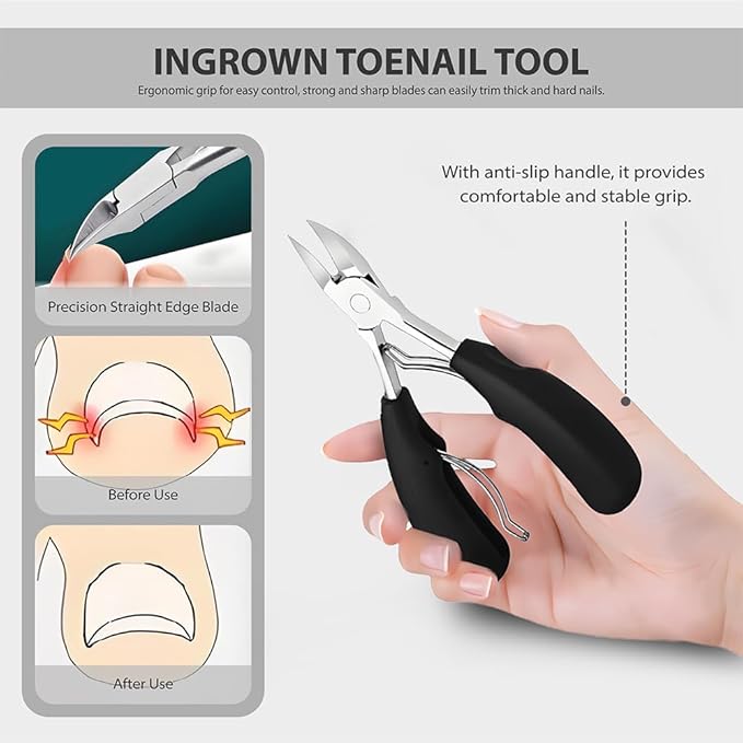 6Pcs Ingrown Toenail Removal Kit, Pedicure Tools for Feet with Fingernail & Toenail Clippers, Professional Nail Cutter Set for Thick Nails, Manicure & Nail Care Tools for Men & Women