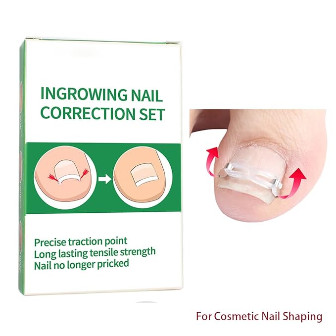JIUDOUCUOIngrown Toenail correction Kit, Professional Nail Care Tools with Correction Clips and Adhesive Pads，Four correction clips can correct two toenails simultaneously