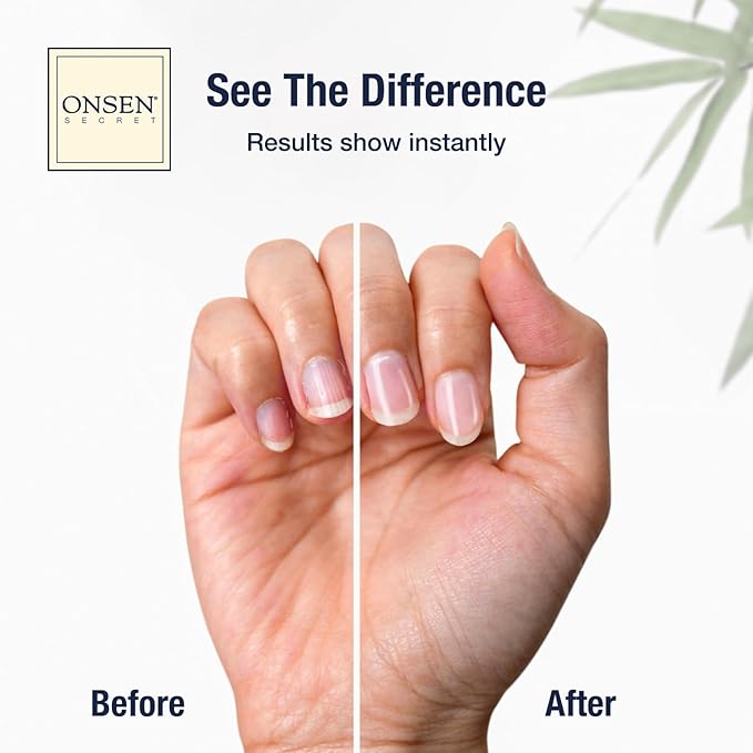 Onsen Secret Complete Nail Reboot Kit w/Cuticle Oil 10ml, Nail File 120/180 Grit Double Sided, A 3-Way Buffer Block & Cuticle Serum-15ml in Action | Super Value Pack