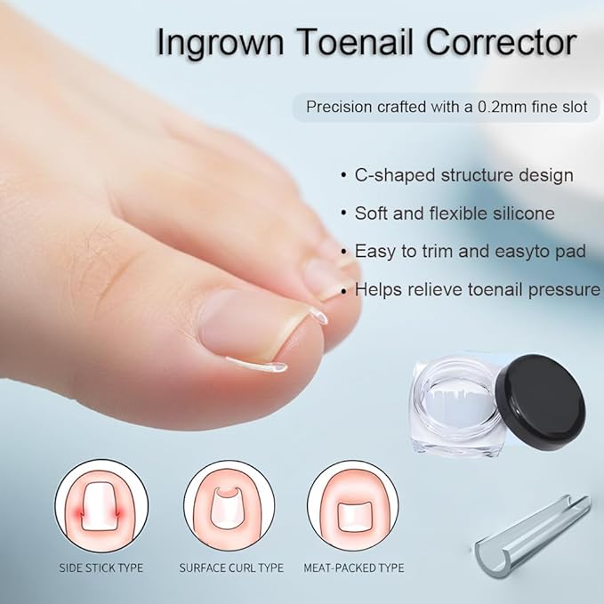 Ingrown Toenail Corrector Set, Professional Toenail Care Set with U-Shaped Breathable Strips, Curved Nail Correction Patch, Painless File & Lifter Tools, At-Home Foot Care for Men & Women.
