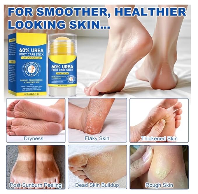 60% Urea Cream with 2% Salicylic Acid Urea Foot Care Stick, Foot Cream Moisturizer for Dry Cracked Feet, Knees, Elbows, Hands,Moisturizes and Hydrates Dry Skin,Callus Remover & Skin Softener -1.41oz