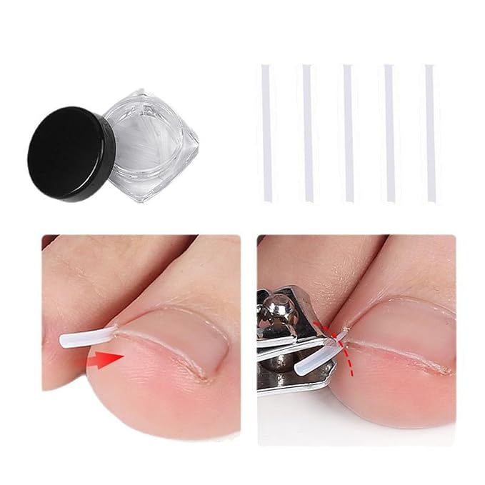 Professional Ingrown Toenail Set with Breathable Ingrown Toenail Strips,Toenail Correction Strips, Curved Toenails Corrector Patch, Painless File and Lifter Pedicure Tools
