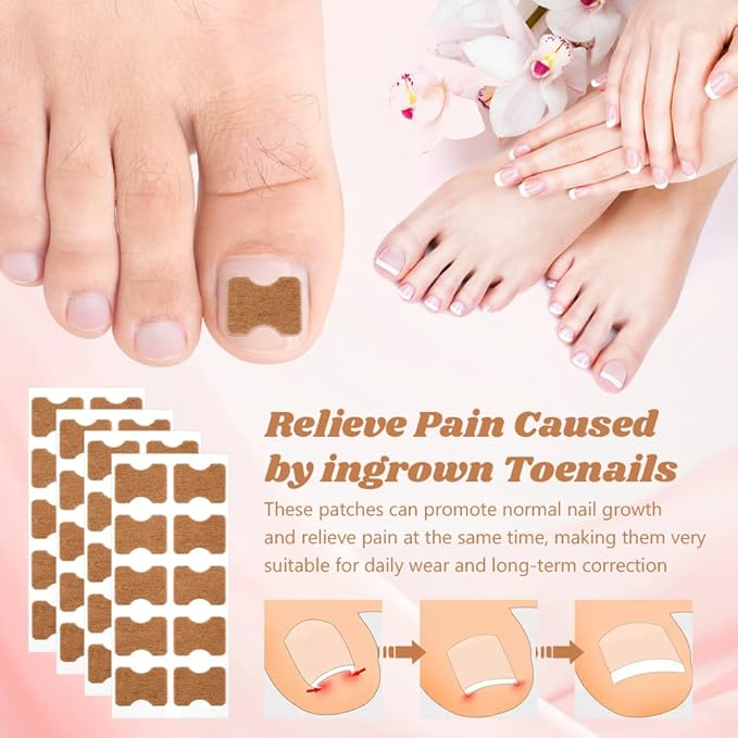 Professional Ingrown Toenail Corrector Set with Correction Strips – Complete Home Pedicure Kit for Men & Women, Non-Slip, Breathable, Pain-Free Relief