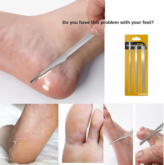 3PCS Stainless Steel ingrown toenail Pedicure Knife Set, Professional Foot Skin Scraper Repair Sharp Blade kit for Nail Corn Callus Paronychia Treatment (with Holes)