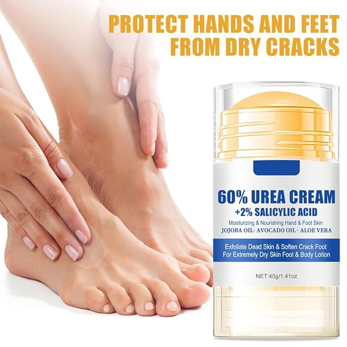 60% Urea Cream plus 2% Salicylic Acid Foot Cream for Removing Calloused Skin, Cracked Hands Elbows Feet Heels Moisturizes and Hydrates, Maximum Strength Moisturizing Foot & Hand Cream, 1.41*2 oz