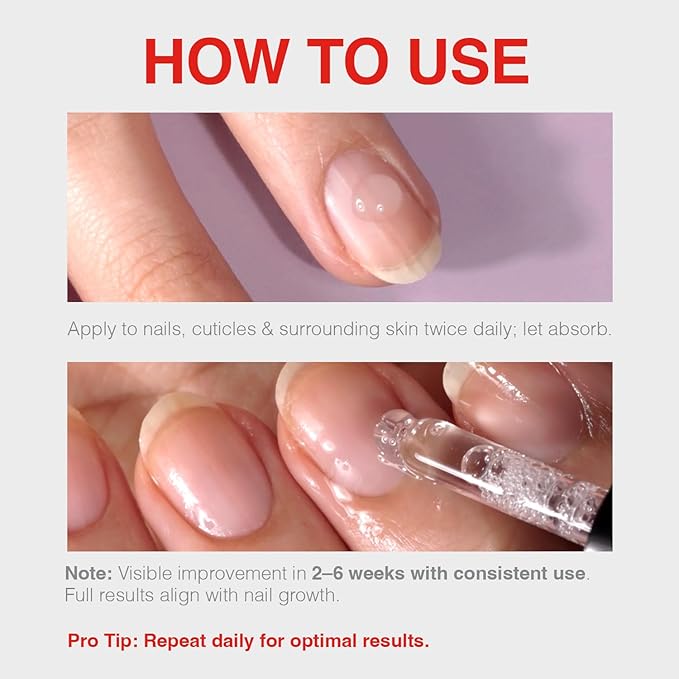 Probelle Natural Renewal Nail Oil, Nail Color Restoration, Clear Topical Solution, Restores Appearance of Discolored or Damaged Nails, .5 oz/ 15 ml
