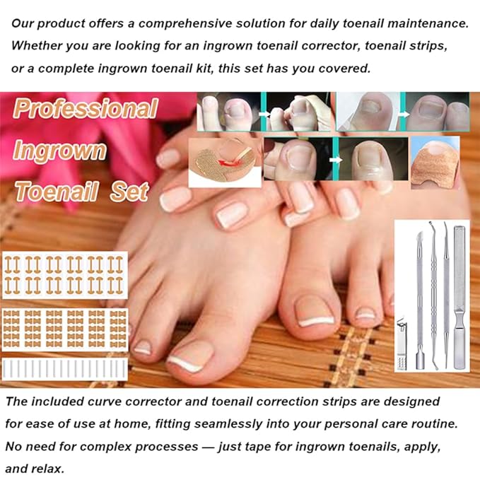 Ingrown toenail treatment, Professional ingrown toenails pedicure tool set, 60Pcs Breathable Toenail Corrector Patch with File and Lifter for Home Pedicure Care