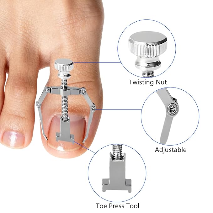 Professional Ingrown Toenail Correction Kit - Stainless Steel Ingrown Toenail Clippers, Correction Patches, Lifter & Tools for Ingrown Toenail Treatment, Home Pedicure Solution
