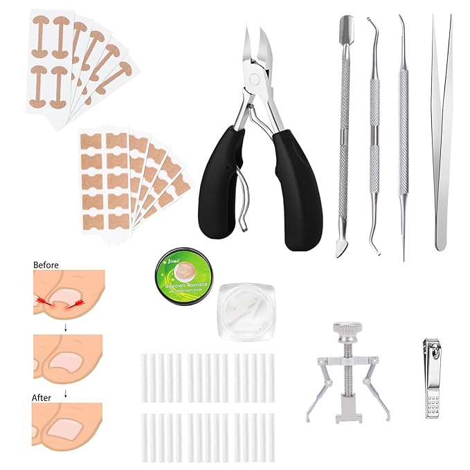Ingrown Toenail Corrector Set,Professional Foot Care Kit for Treatment & Removal,Includes Ingrown Toenail Corrector,Strips,Tools