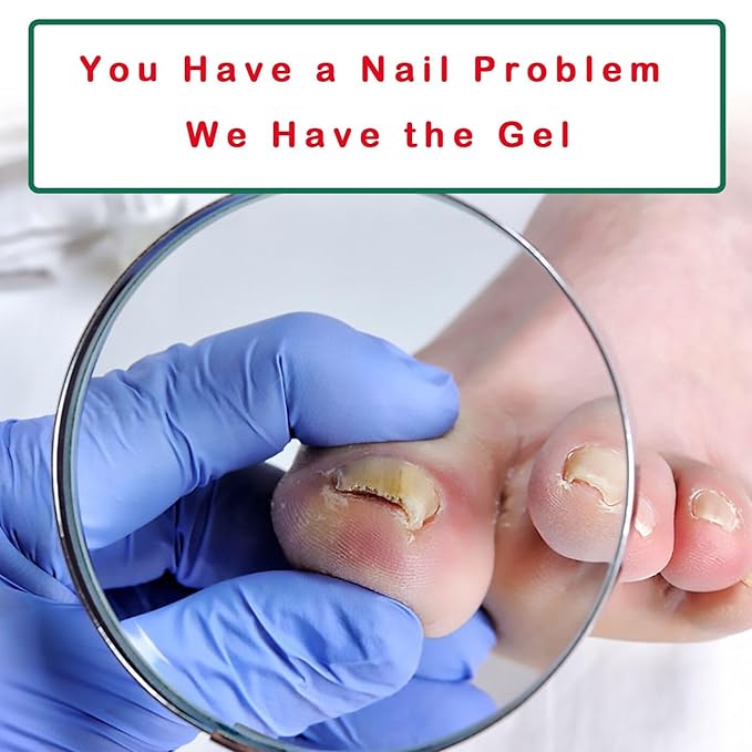 Nail Treatment Gel - 2 PCS Nail Growth Repair Cream for Fingernails and Toenails, Fix & Renew Damage Fungal Nail, Broken, Cracked & Discolored Nails