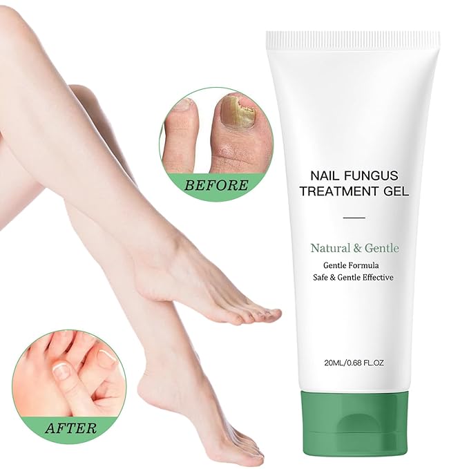 Natural Nail Treatment Gel, Nail Growth Serum for Repair & Strengthener (2)