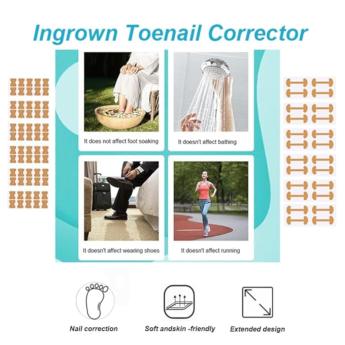 Ingrown toenail treatment, Professional ingrown toenails pedicure tool set, 60Pcs Breathable Toenail Corrector Patch with File and Lifter for Home Pedicure Care