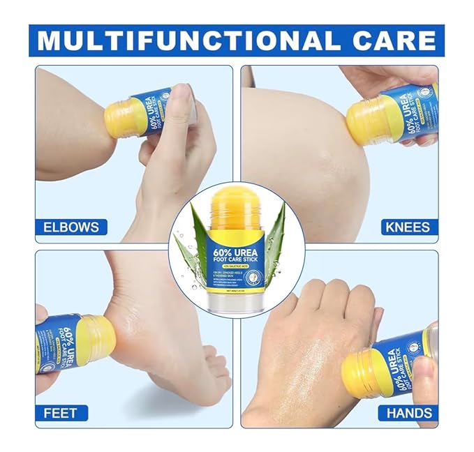 60% Urea Cream with 2% Salicylic Acid Urea Foot Care Stick, Foot Cream Moisturizer for Dry Cracked Feet, Knees, Elbows, Hands,Moisturizes and Hydrates Dry Skin,Callus Remover & Skin Softener -1.41oz