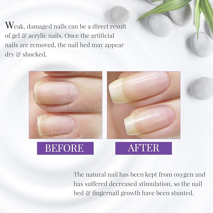 Nail Tek Foundation Xtra 4, Ridge Filling Strengthening Base Coat for Weak and Damaged Nails, 0.5 oz, 2-Pack