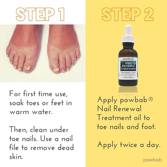 powbab Nail Renewal Treatment for Toenail. Pine Needle Scent, No Acid Formula. 100% Natural Solution Toenail Treatment Extra Strength for Foot and Nail. Natural Toe Nail Treatment - 1 oz