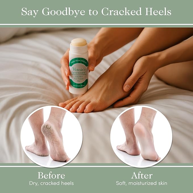 Victoria's Lavender Heel Balm Stick – Ultra-Rich Foot Therapy Balm for Dry, Cracked Feet – Softener for Cracked & Rough Skin – Dry Heels Treatment for Men and Women – Made in USA - Lavender Mint 2.5oz