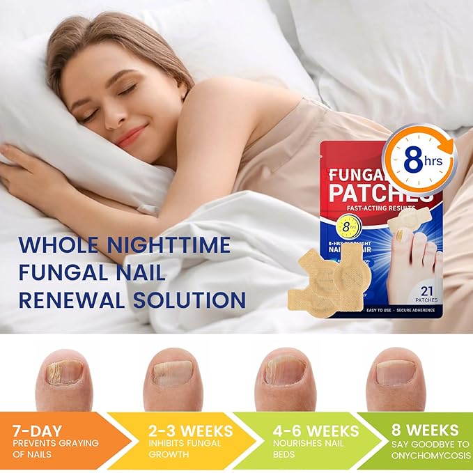 Toenail Fungus Treatment Extra Strength - 21 Pcs Fungal Nail Patches, 8-Hour Firm Adhesion, Nail Repair for Damaged Nails, Overnight Renewal for Men & Women (1 Count (Pack of 21))