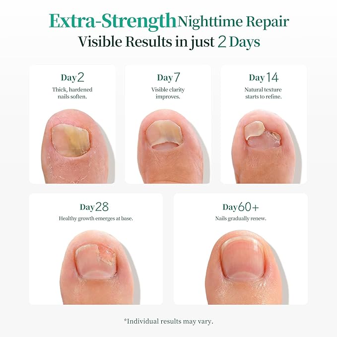 APUREE Fungal Nail Patches Extra Strength: True 1% Tolnaftate | 8H Overnight Fungal Toe Nail Treatments |Repair For Discolored Yellow Brittle Damage Nails| Revives Natural look| 64 Patch