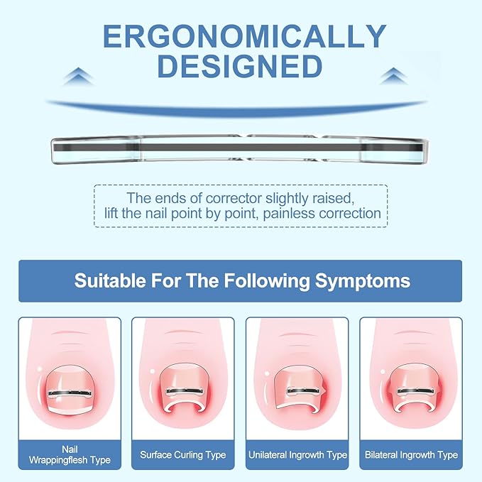 12Pcs Ingrown Toenail Corrector Strips for Curved Toenail Quick Relief,4 Multi-Sizes Ingrown Toenail Treatment Relief Tools Kit for Home Use