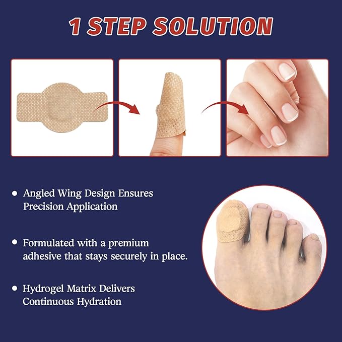 30 Pcs Extra Strength Nail Repair Patches - Overnight Renewal for Damaged, Discolored & Thickened Toenails & Fingernails for Men and Women